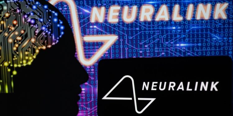 How to Invest in Neuralink: A Future of Neuroscience